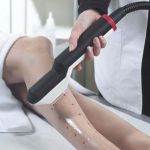 Depilación láser, olvídate de los pelos