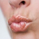 Cómo prevenir los labios agrietados